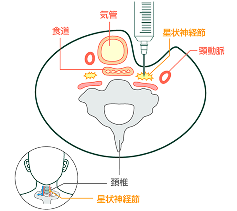 参考画像2